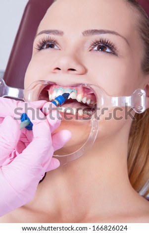 Female patient in a dental treatment