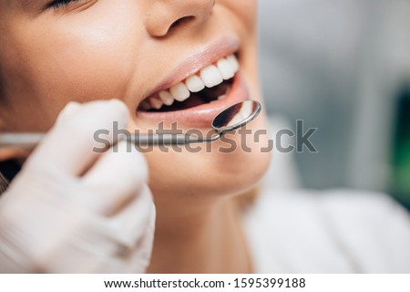 attractive caucasian woman visiting dentist, doctor doing dental examination before treatment, ideal teeth Stockfoto © 