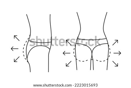 Buttock increase of woman, shape butt with arrow and contour, line icon. Augmentation flat, reshape buttocks. Cosmetic medical procedures, clinic of plastic surgery. Vector outline illustration