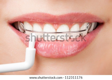 cleaning teeth with retainer