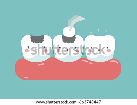Filling tooth ,teeth and tooth concept of dental 
