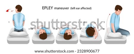 Epley maneuver illustration, a practical guide for the treatment of positional paroxysmal vertigo. With damage to the left ear. Vector.