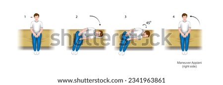 Illustration of the Appiani maneuver, a practical guide to the treatment of benign positional paroxysmal vertigo (bppv). With damage to the right ear. Training manual, education. Vector.