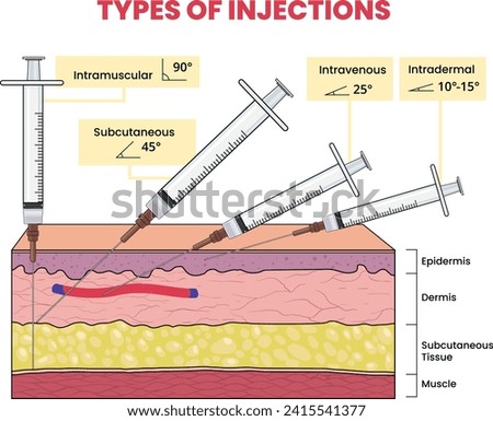 illustration of injection types infographic 