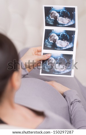Ultrasound photographs. Top view of pregnant woman looking at ultrasound photographs
