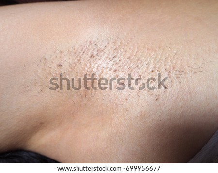 muslims women pussies pictures close hairy pubis mons selfshot