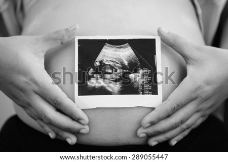 pregnant woman with ultrasound baby scan black and white style