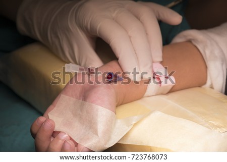 The Arterial Line : Arterial line and central pptx powerpoint