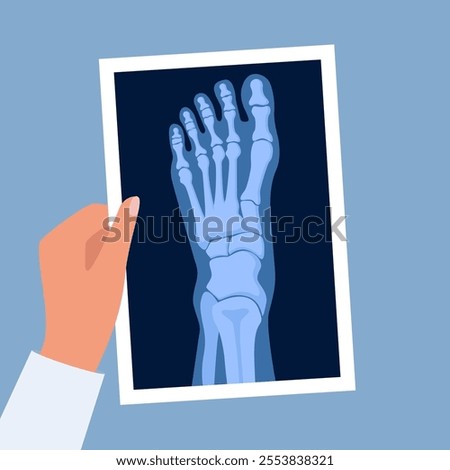 X ray human foot. X-ray picture or radiographic monitor image of metatarsus bones and toes. Medical radiology. Roentgen shot in doctors hand. Vector illustration