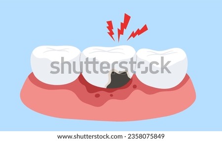 Pain of tooth decay on red pain gum. Concept of tooth cavity, toothache, dental care, dentistry, oral health, dentist, mouth, tooth caries. Flat vector illustration.  Stock foto © 