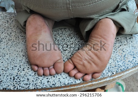 dirty child feet, painted nail polish feet, closeup