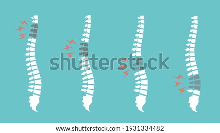 Backache spines set. Back pain vector icon illustration isolated. Damaged Dorsal Disks