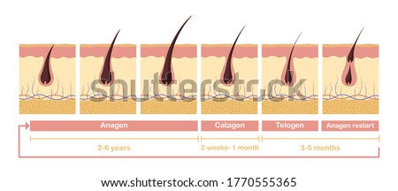 Hair growth cycle illustration. Anatomical diagram of development hair follicles from anagen telagen care papillae skin epidermis and health promoting stimulation vector growth hair cells.