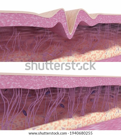 Skin regeneration. Collagen and elastin fibers renewal process. 3D render. Illustration before and after rejuvenation skin treatment. Foto d'archivio © 