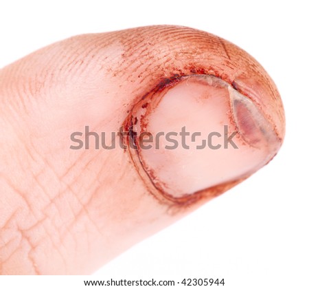 Finger cut with sharp knife, not imitated, macro