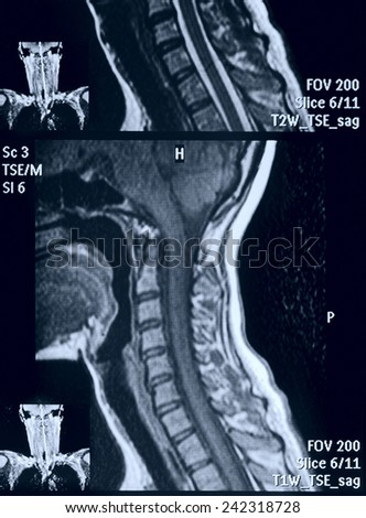 Head and neck MRI scan, no personal data