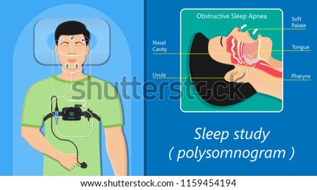 PSG sleep study test apnea diagnose Periodic limb movement disorder positive airway pressure CPAP restless leg syndrome Epworth Sleepiness Scale