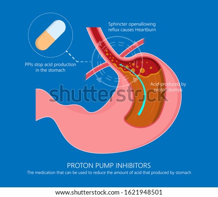 Proton pump inhibitors drugs PPIs medication treatment stomach acid Gastroesophageal reflux disease GERD H2 receptor blockers Pepcid AC over the counter long term use side effects Peptic Barrett