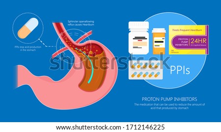 Proton pump inhibitors drugs PPIs medication treatment stomach acid Gastroesophageal reflux disease GERD H2 receptor blockers Pepcid AC over the counter long term use side effects Peptic Barrett PPI