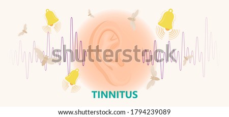 Tinnitus disorder a ringing sound in the ear hearing loss wave level anxiety test assist exam inner exposure problem circulatory nerves hair cell canal Earwax