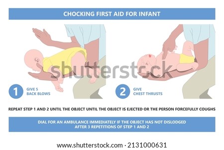 Choking first aid baby food CPR child step lodges blocking victim adult help abdomen kids conscious poster swallow back blows chest rescue breath care safety Сток-фото © 