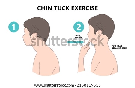 Chin Tuck Head Text neck lift pain nerve deep flexor spine inflamed bad correct poor good phone smart tablet laptop use work from home chiropractor strain upper back Jaw Joint outlet stress injury
