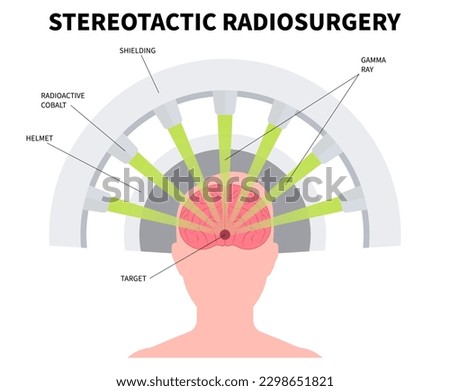 Gamma tumor cancer treat exam body X-ray MRI imaging scan medicine focus disease accelerator central nervous system beam CT Linac linear particle oncology Knife minimally invasive radiosurgery