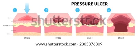 Similar – Image, Stock Photo wound healing