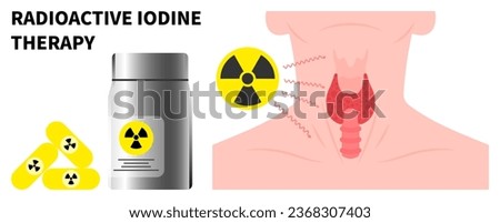 Nuclear medicine for Neck swelling with Radioactive iodine to treat Graves' and Hashimoto's disease