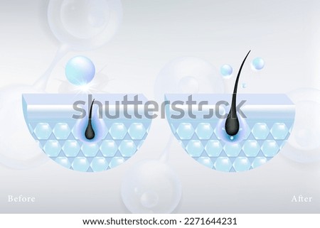 Hyaluronic acid before and after hair and skin solutions ad. blue collagen serum drop into skin cells with cosmetic advertising background ready to use, illustration vector.	
