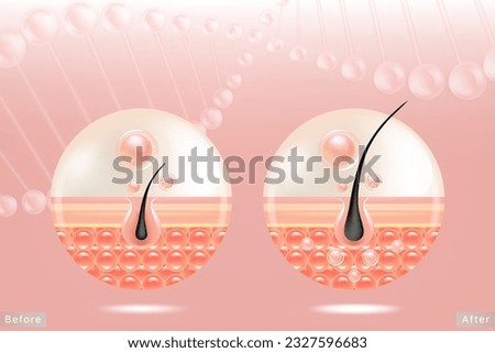 Hyaluronic acid before and after hair and skin solutions ad. pink collagen serum drop into skin cells with cosmetic advertising background ready to use, illustration vector.