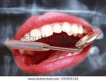 Health care. Closeup of human teeth and dental mirror on panoramic x-ray image scan background.