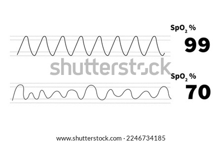 normal oxygen saturation waveform with poor baseline waveform monitoring