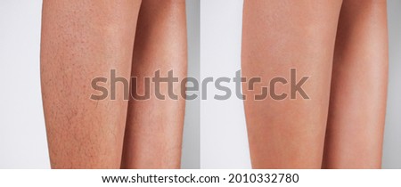 Image before and after Legs hairs removal concept.  商業照片 © 