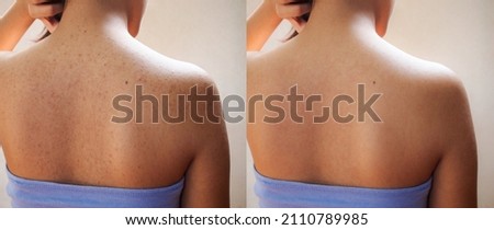 Similar – Image, Stock Photo back Back Skin Woman