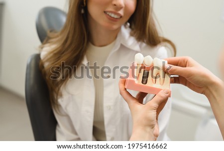 First person shot female doctor talking to a young woman patient. Discussion of the treatment plan. The dentist shows a model of a dental implant. Modern dental clinic