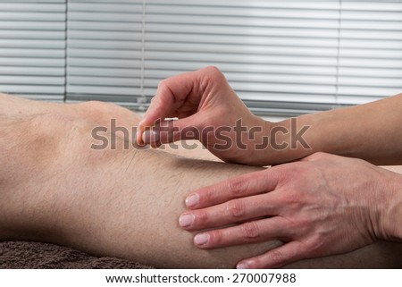 Man Undergoing Acupuncture Treatment- Gall bladder