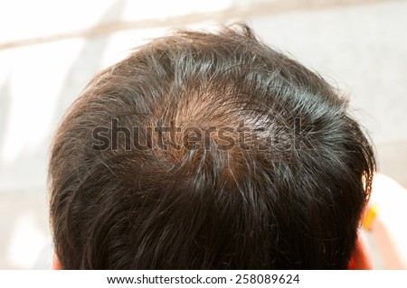Hair loss, thinning hair and scalp