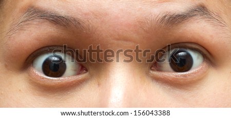 Close-up picture of brown eyes from a young man