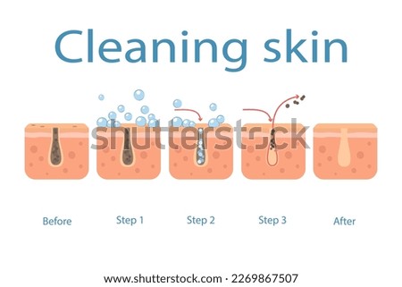 Skin cleaning steps on clogged face, facial skin care, pore cleaning.