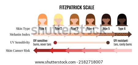 Fitzpatrick skin tone scale phototype melanin index with female avatar. Chart element with type I II III IV V IV human skin hair color melanin content in the cell cancer risk flat vector illustration