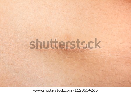 
Closeup of Scars Imagine de stoc © 