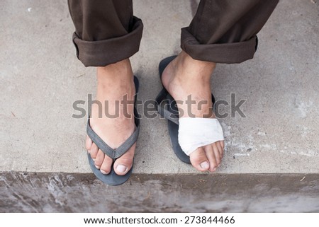 bandaged foot,foot injury