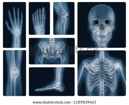 Realistic x-ray shots of human bones of skull pelvis thorax knee and limbs isolated vector illustration   Foto d'archivio © 