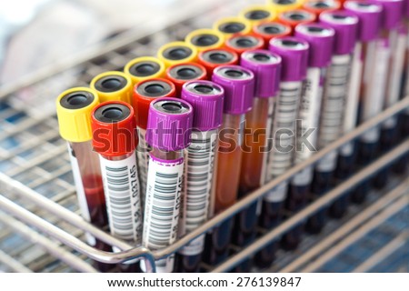 blood sample tubes