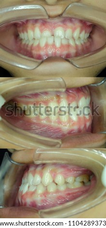 Similar – Image, Stock Photo portrait of teenager III