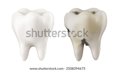 Dental dentists treat teeth decay  teeth decay treatment concept. remove plaque, treat teeth decay. medical apps, websites and hospital. 3D Mesh gradient wes.
