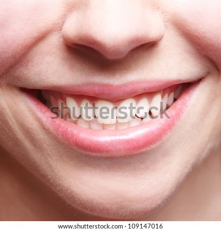 Close-up of smiling female mouth with bright teeth showing