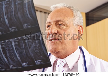 Doctor looking at an x-ray image of a human spine in a hospital