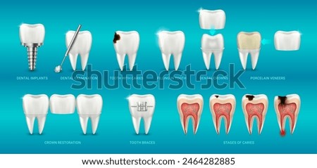 Medicine and healthcare in clinic, teeth care and treatment. Vector dental examination, braces and implants, crown restoration and porcelain veneers, stages of caries and prosthesis filling in tooth